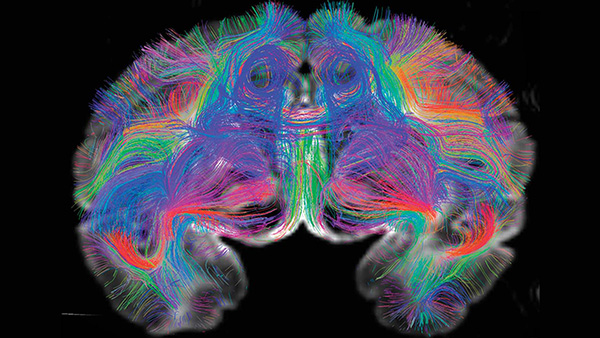 Human Connectome Project