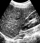 Emergency ultrasound