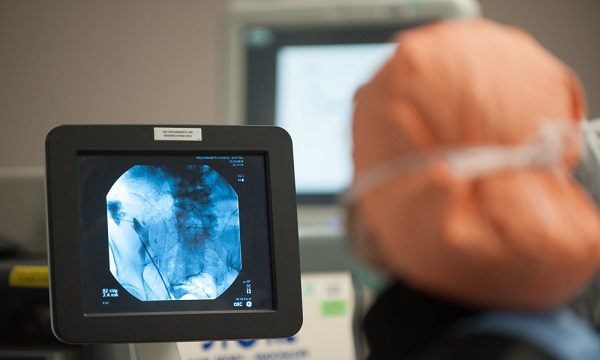 Doctors performing a minimally invasive surgery Doctors performing a minimally invasive surgery